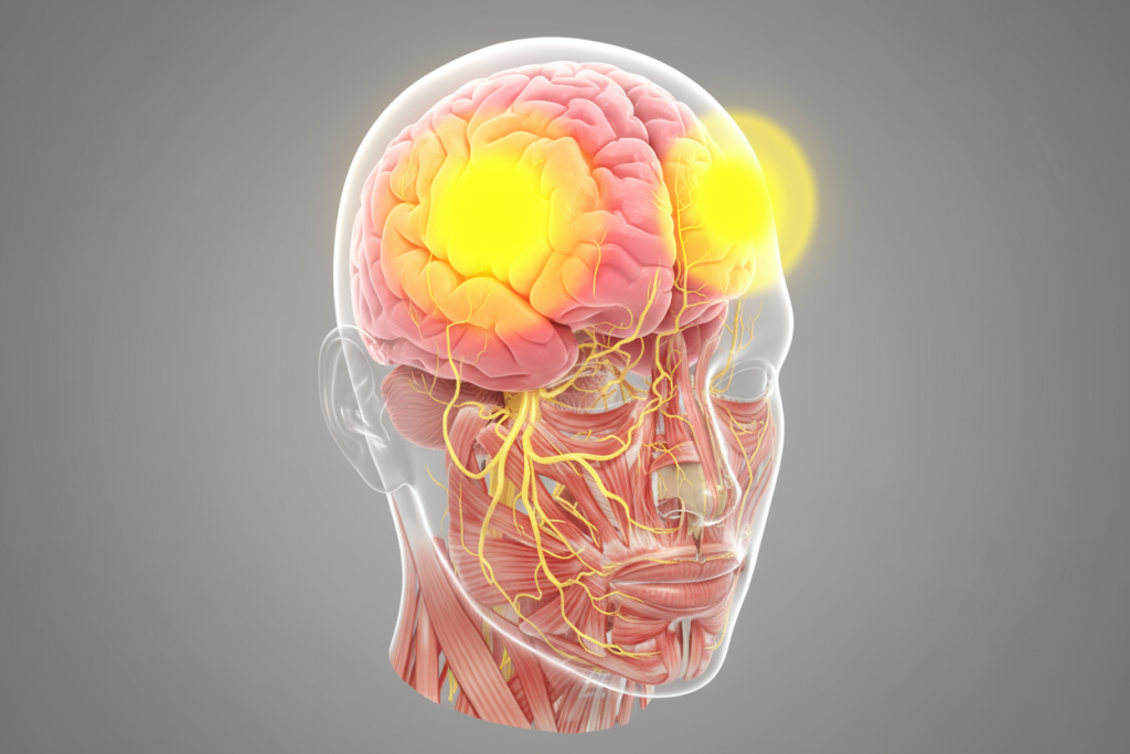 Мигрень_1.png Мигрень_1.png