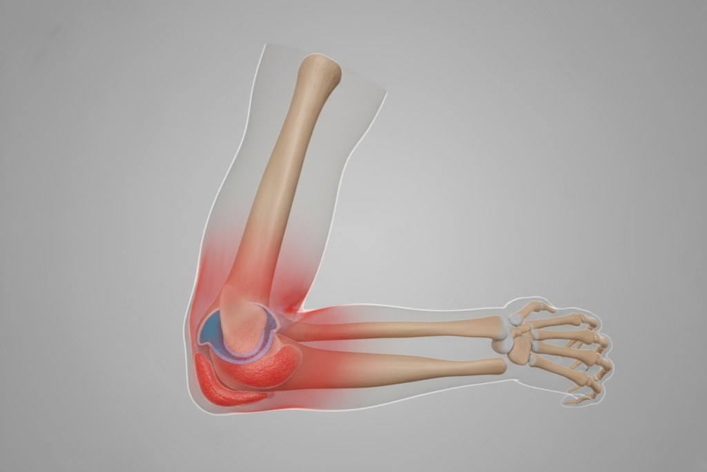 Локтевой бурсит_1.png Локтевой бурсит_1.png